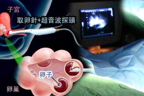 湖南省三代试管婴儿医院介绍,孕妇第一次在湖南湖南妇幼医院建档的流程是什